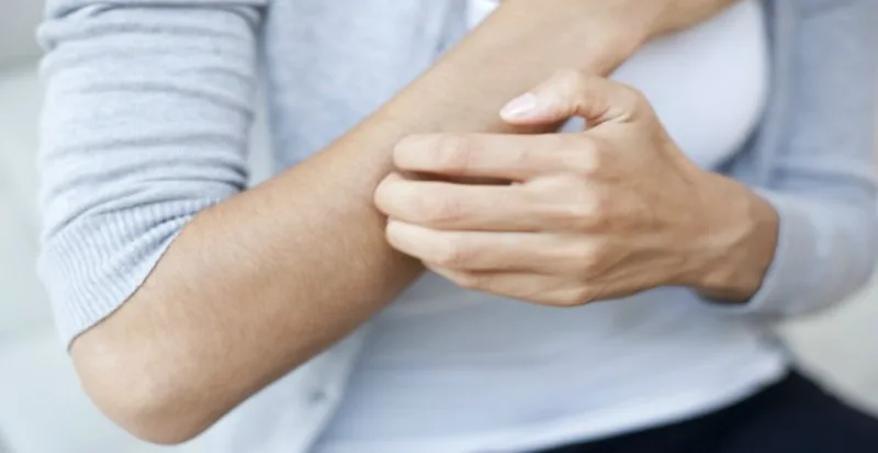 Dermatitis