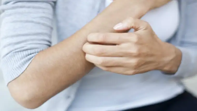 Dermatitis