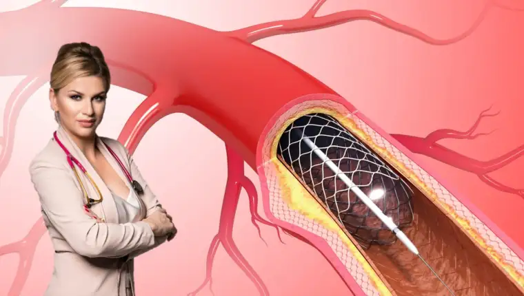 Stent2