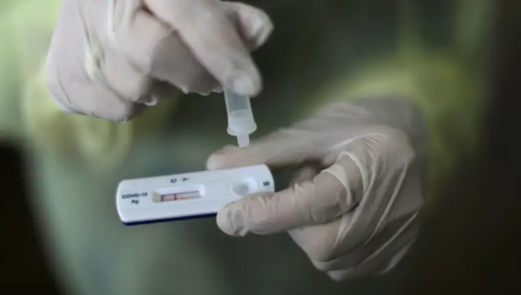 Antigenski test