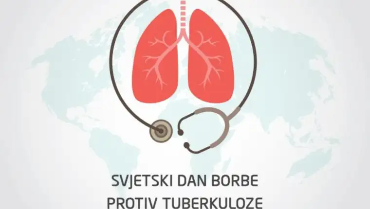 Tuberkuloza