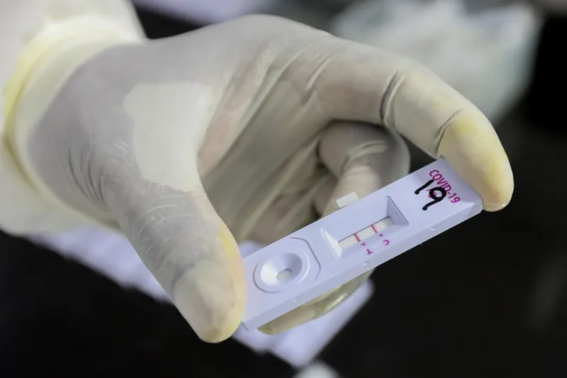 Antigenski test1