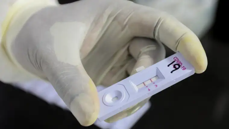 Antigenski test1