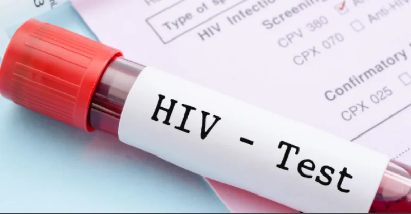 hiv 45