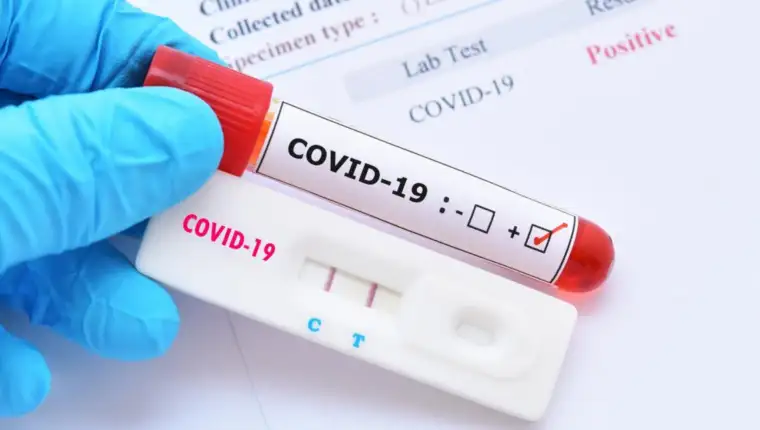covid-test-2-1140x684