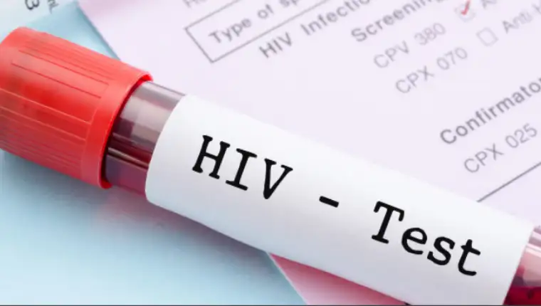 hiv 45