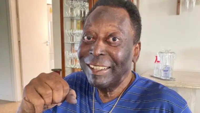 pele 34