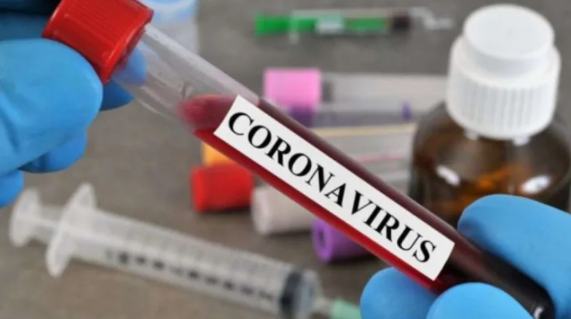 koronavirus 34