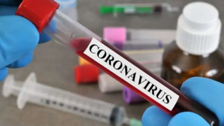 koronavirus 34