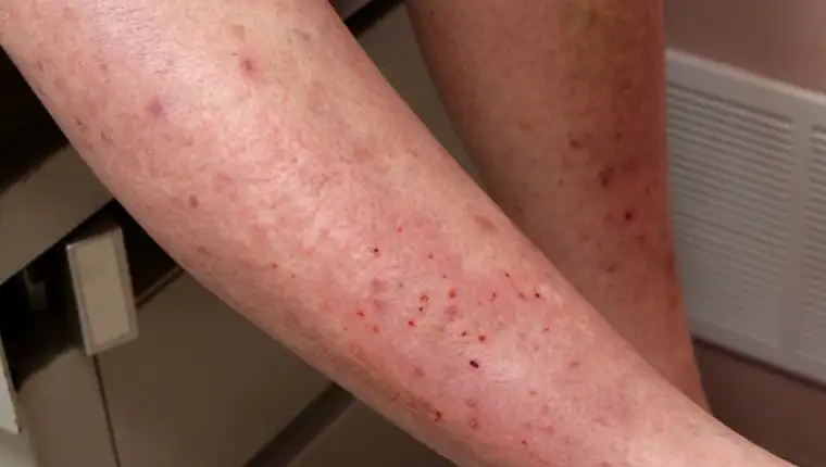 Screenshot_37