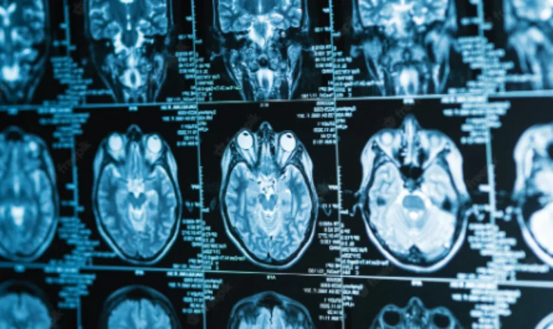 brain scan 1