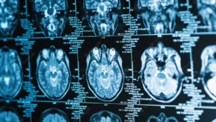 brain scan 1
