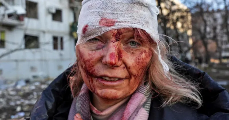 krvava zena ukrajina