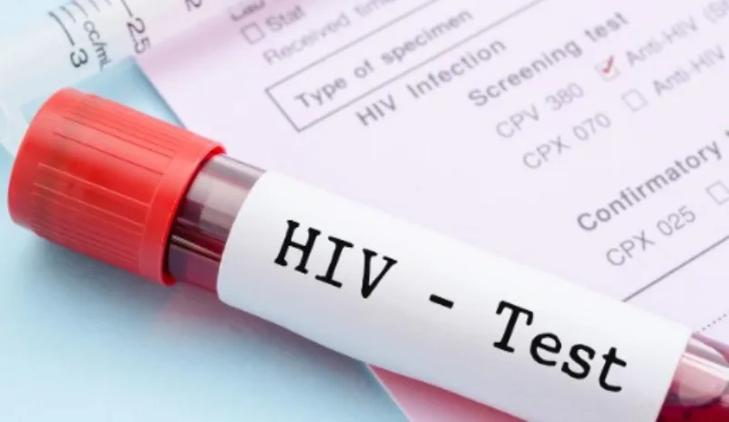 hiv test 56