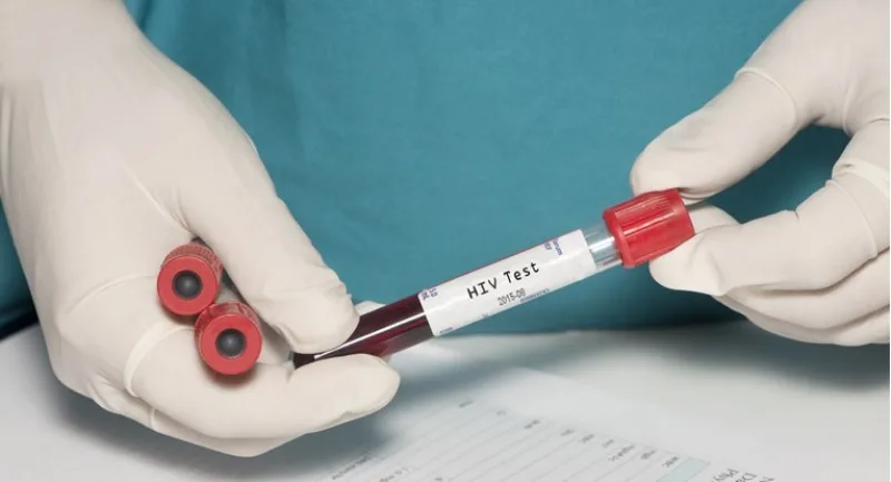 hiv