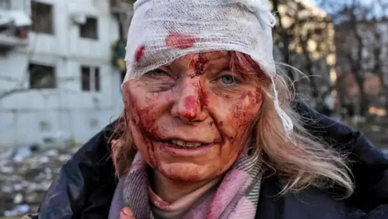 krvava zena ukrajina