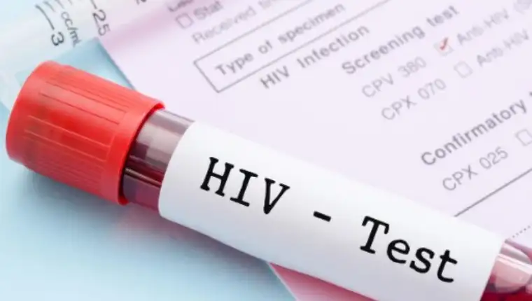 hiv test 56