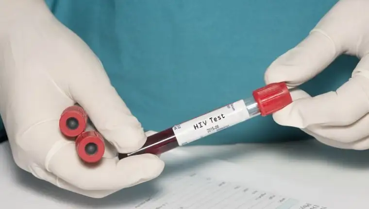 hiv