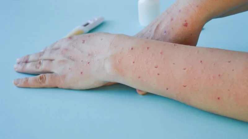 paradajz virus