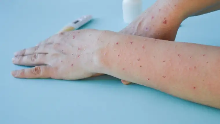 paradajz virus