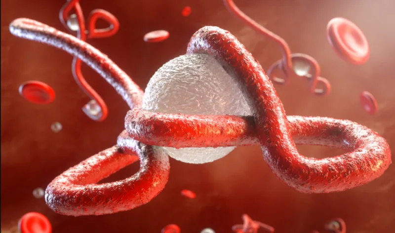 ebola virus 3