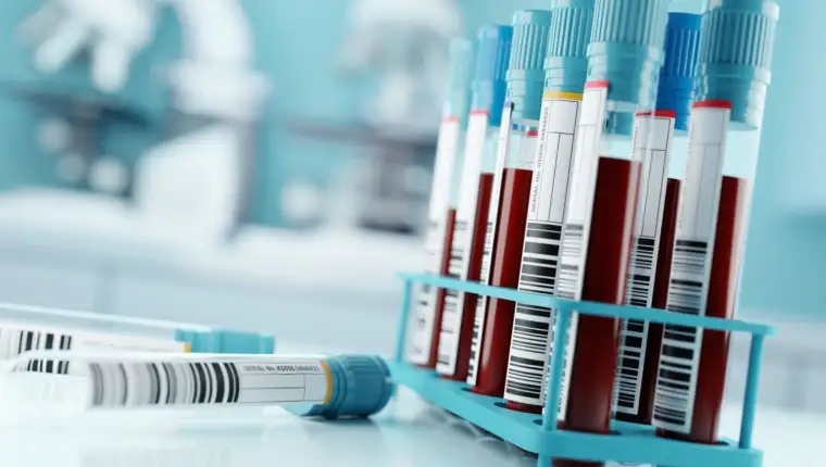 Blood Test Results In A Medical Lab