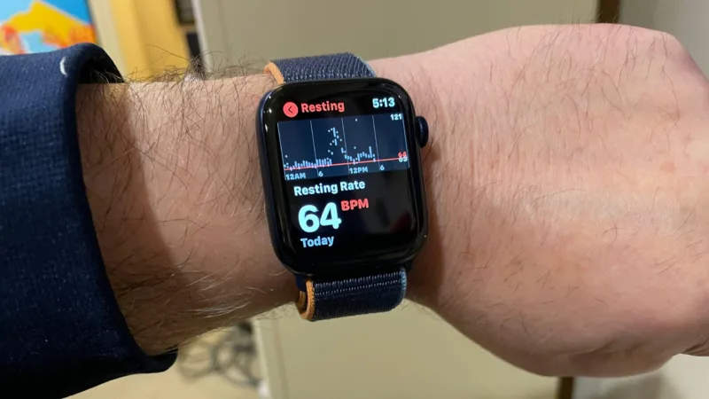 appale watch