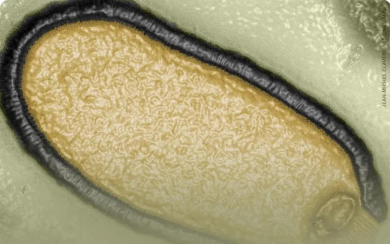 virus 2
