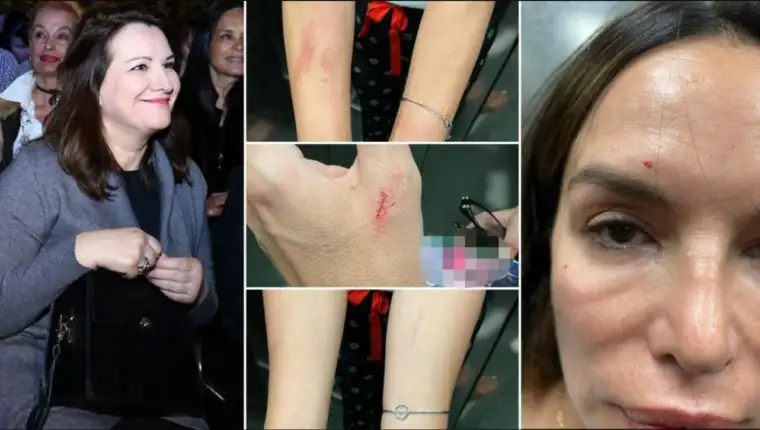 severina sestra tuca