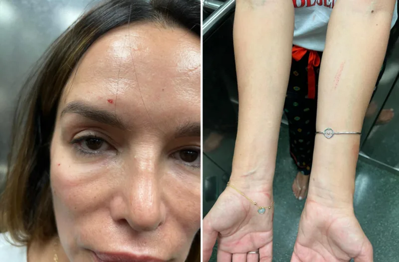 severina tuca