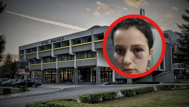 jablanica klepo