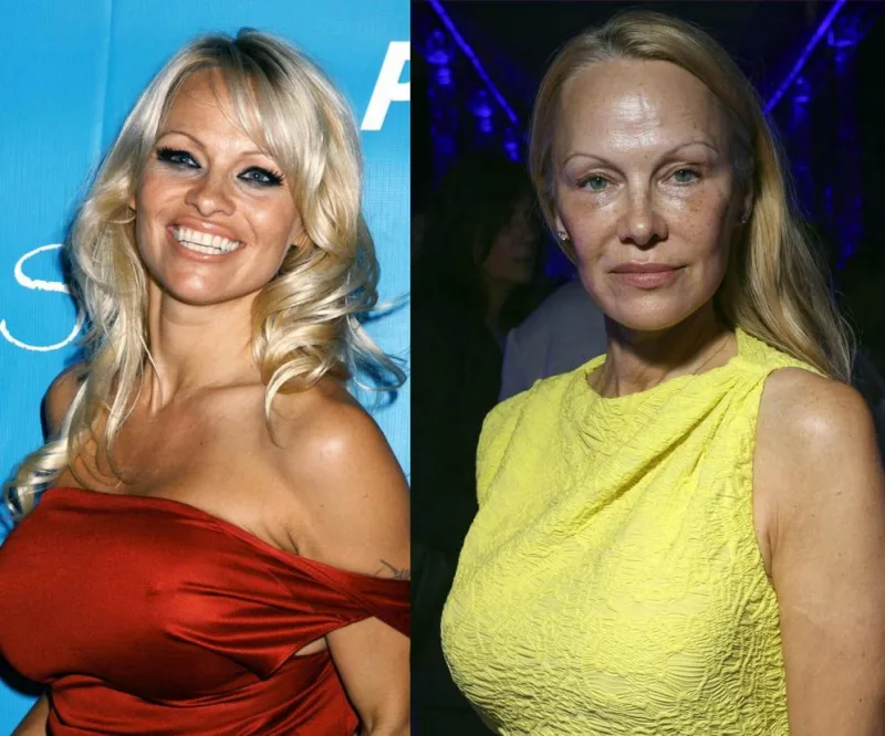 Pamela Anderson1