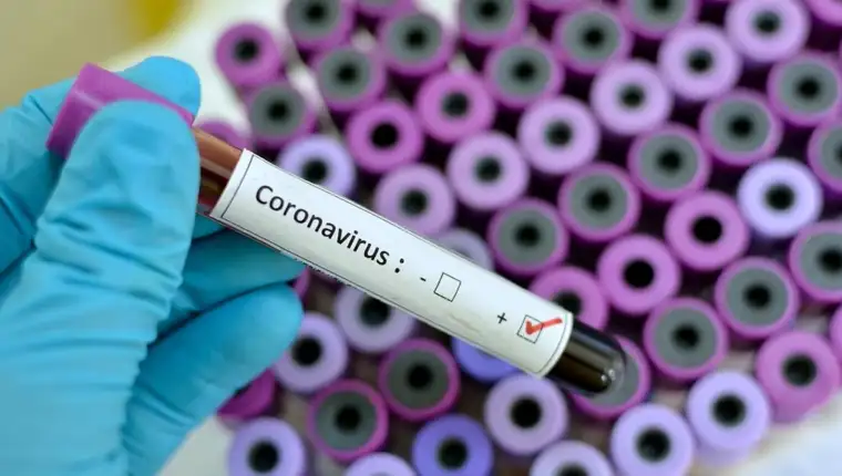 2020-02-24-coronavirus-en
