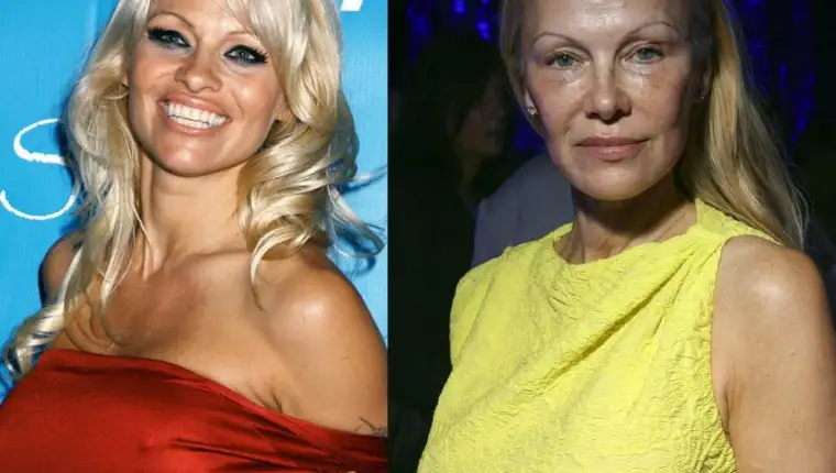 Pamela Anderson1
