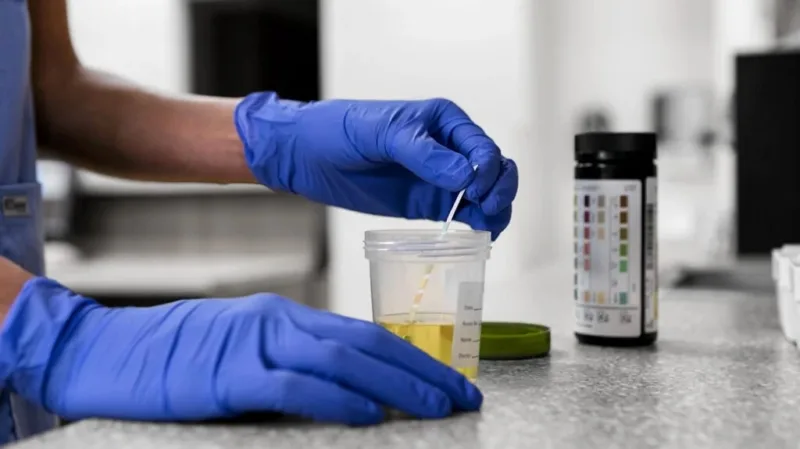 urin laboratorija