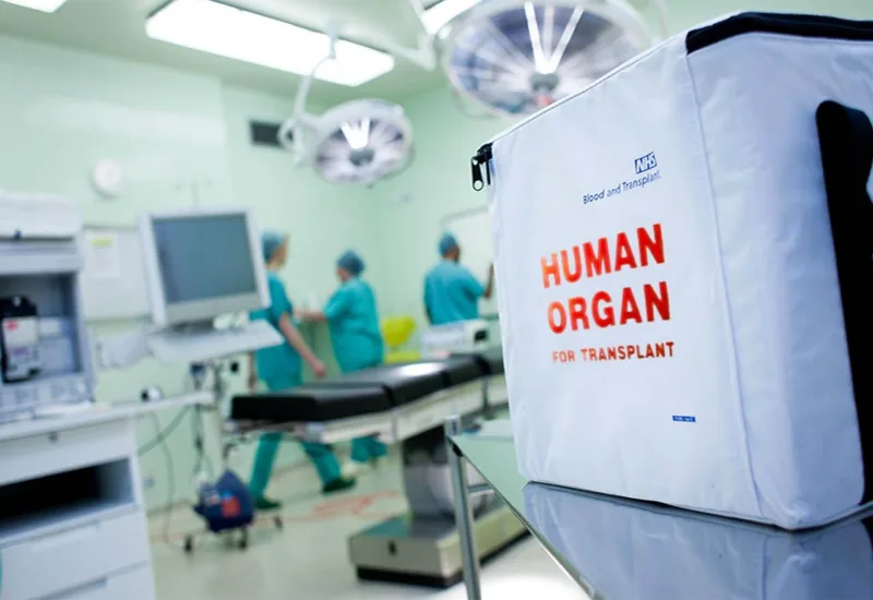 transplantacije