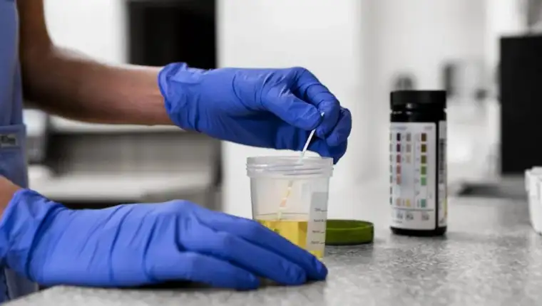 urin laboratorija