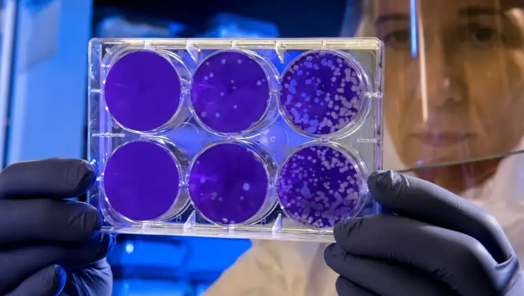 zaraza laboratorija