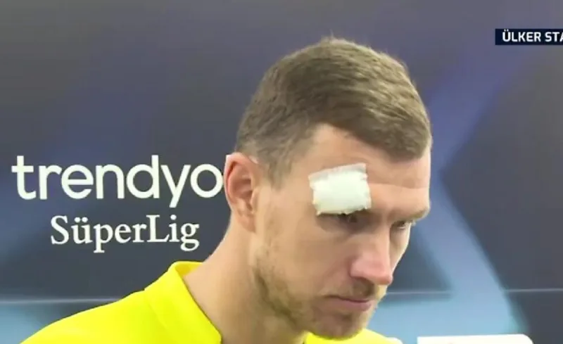 dzeko