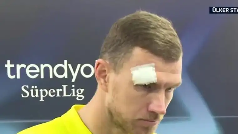 dzeko