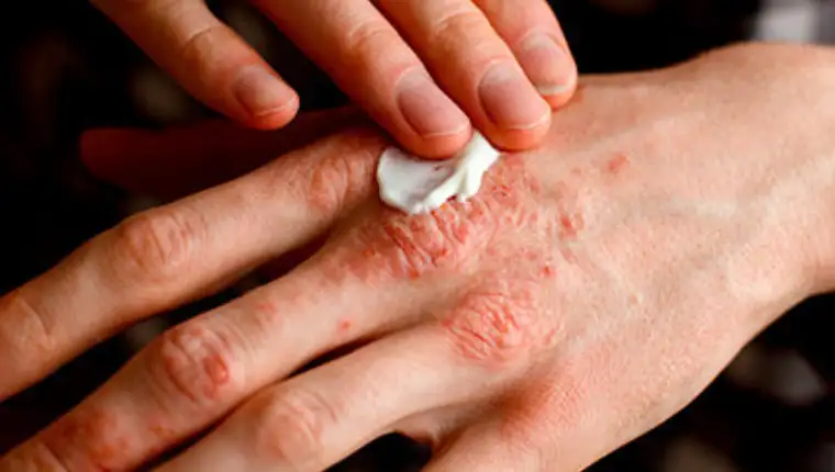 download-2-427x265