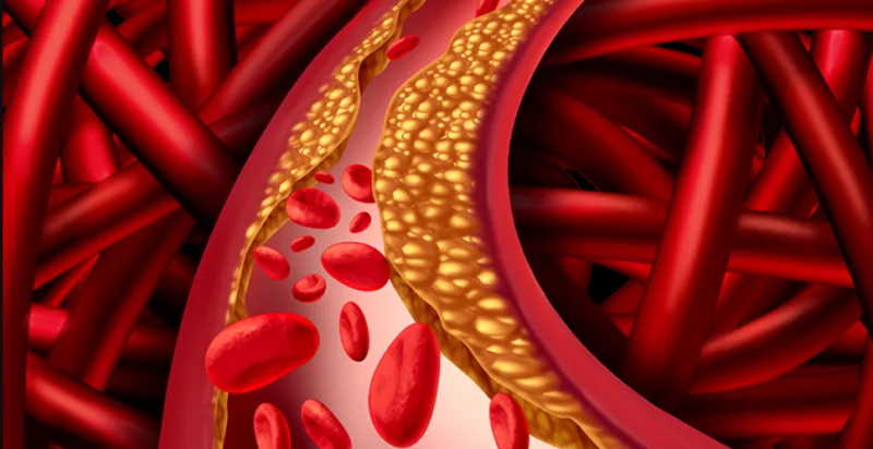 arterije 4