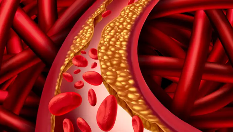 arterije 4