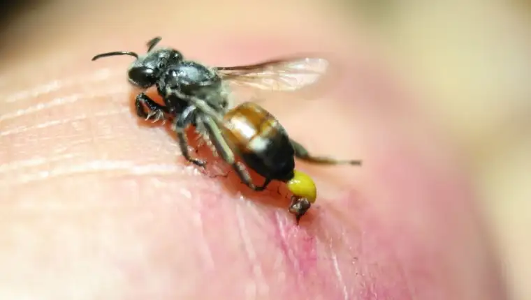 Ubod-pcele-ili-ose-1