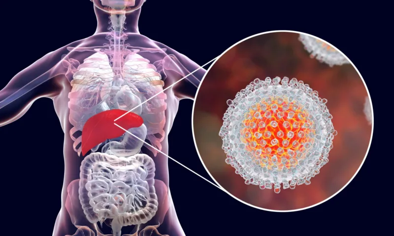 virusni hepatitis