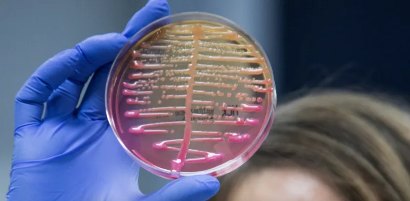 Klebsiella pneumoniae