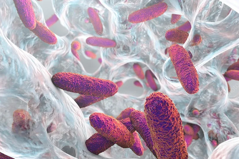 Klebsiella pneumoniae bakterija
