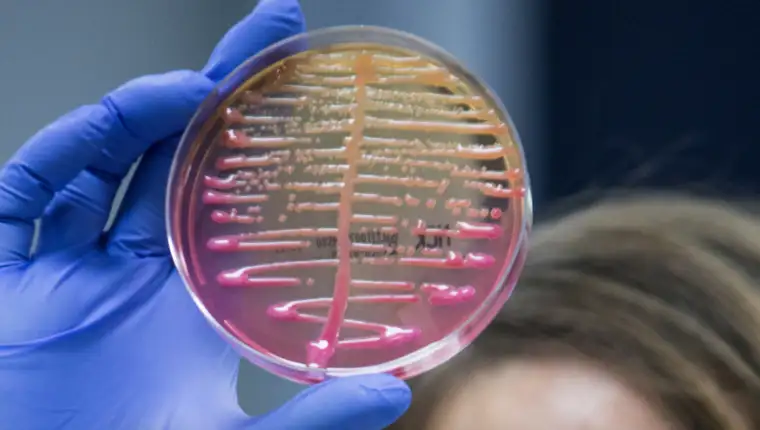 Klebsiella pneumoniae