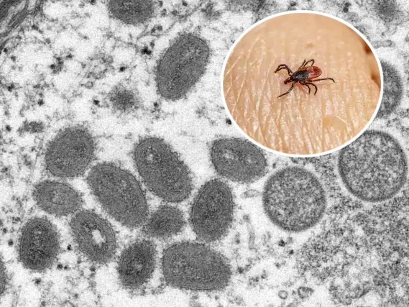 welv virus krpelj