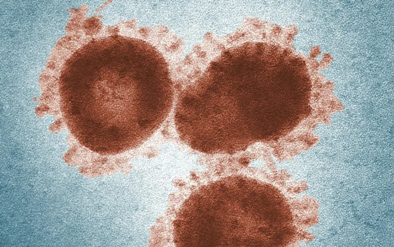 virus
